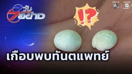 7 วัน 7 อย่าง : เกือบพบทันตแพทย์