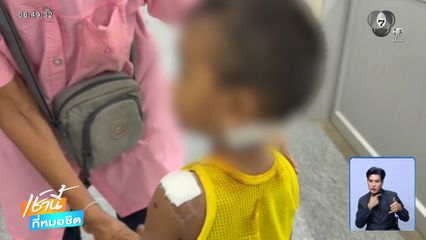 "เจ้าหลง" สุนัขโหด กัดเด็กชาย 4 ขวบ บาดเจ็บ