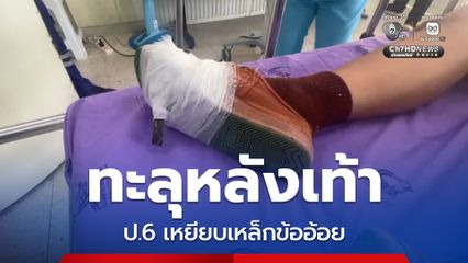 ทะลุหลังเท้า ป.6 เหยียบเหล็กข้ออ้อย