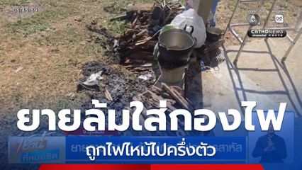 ยายอายุ 81 ปี ล้มใส่กองไฟอาการสาหัส