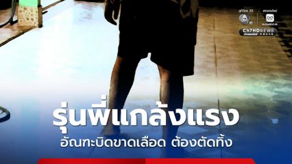 แม่ร้องสื่อ ลูกชายถูกรุ่นพี่แกล้งแรง อัณฑะบิดขาดเลือด ต้องตัดทิ้ง ลั่น สงสารลูก จะต่อสู้ให้ถึงที่สุด