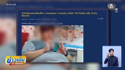 ตัดกระเพาะ เสี่ยงซึมเศร้าได้หรือไม่ ?