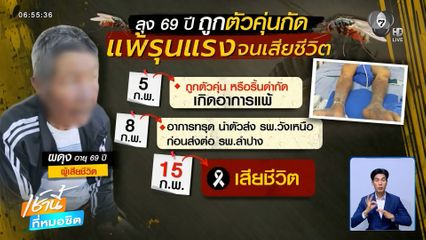 ระวัง ! ตัว "คุ่น" กัด กระตุ้นติดเชื้อถึงตาย