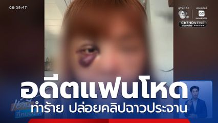 อดีตแฟนโหด ทำร้าย ปล่อยคลิปฉาวประจาน แจ้งความ 3 สน. แต่ยังลอยนวล