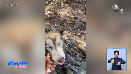 อาการ ไซบีเรียน ถูกเผายังสาหัส