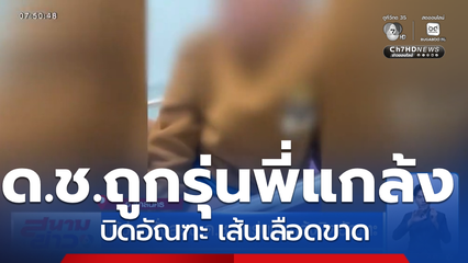 ผู้ว่าฯ สั่งสอบ ด.ช.ถูกรุ่นพี่แกล้งบิดอัณฑะ