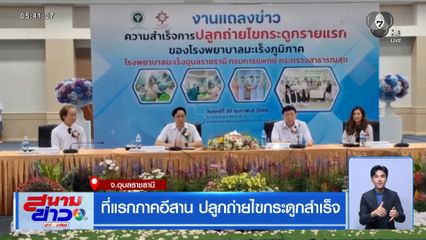 ที่แรกภาคอีสาน ปลูกถ่ายไขกระดูกสำเร็จ