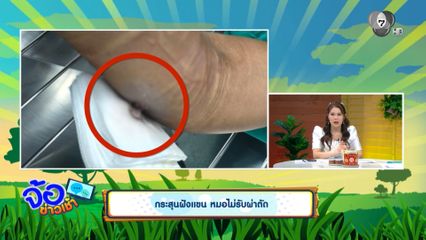 กระสุนฝังแขน หมอไม่รับผ่าตัด