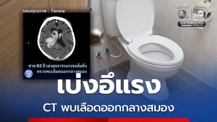 เพจดังเตือน เบ่งอุจจาระแรง ล้มตึงเลือดออกกลางสมอง
