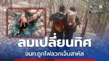 ลมเปลี่ยนทิศ จนท.ถูกไฟลวกเจ็บสาหัส