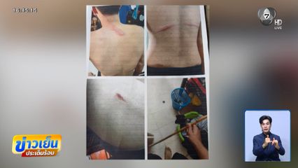 ร้องเอาผิดครูผู้ช่วย ทำโทษนักเรียนเกินกว่าเหตุ