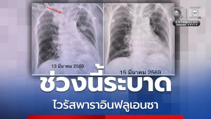 ช่วงนี้ระบาด ไวรัส Parainfluenza ไม่รุนแรงแต่ต้องระวังเด็กเล็ก-คนแก่