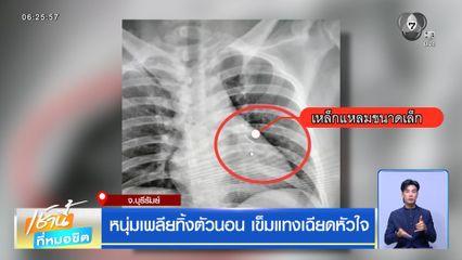 หนุ่มเพลียทิ้งตัวนอน เข็มแทงเฉียดหัวใจ