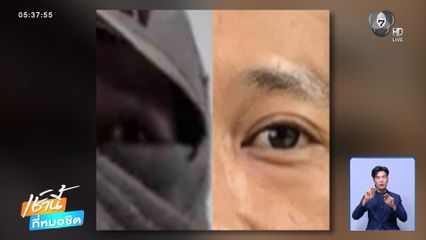 สืบจากแววตา จับโจรผ้าขนหนู จ.ขอนแก่น