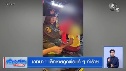 เวทนา ! เด็กชายถูกพ่อแท้ ๆ ทำร้าย