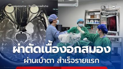 สำเร็จ! ผ่าตัดเนื้องอกสมองผ่านเบ้าตา โดยไม่ต้องเปิดกะโหลก ฝีมือแพทย์ไทย โรงพยาบาลลำปาง