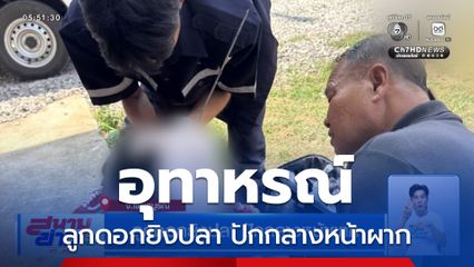 ลูกดอกยิงปลา ปักกลางหน้าผาก