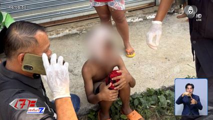 ลูกดอกยิงปลา ปักกลางหน้าผาก