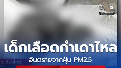 เด็กเลือดกำเดาไหล อันตรายจากฝุ่น PM2.5