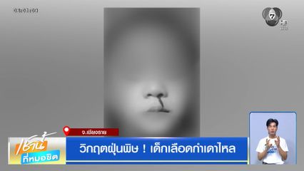 วิกฤตฝุ่นพิษ ! เด็กเลือดกำเดาไหล