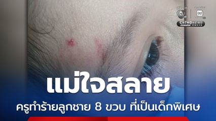 แม่ใจสลาย ครูทำร้ายลูกชาย 8 ขวบ ที่เป็นเด็กพิเศษ