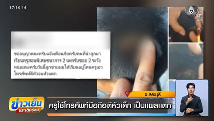 ครูใช้โทรศัพท์มือถือตีหัวเด็ก เป็นแผลแตก