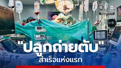 สุดยอด! รพ.สรรพสิทธิประสงค์ “ปลูกถ่ายตับ” สำเร็จแห่งแรกของ สป.สธ.