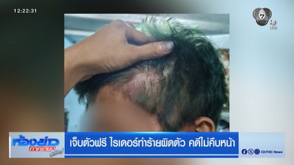 เจ็บตัวฟรี ไรเดอร์รุมทำร้ายผิดตัว คดีไม่คืบหน้า