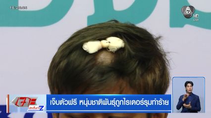 เจ็บตัวฟรี หนุ่มชาติพันธุ์ถูกไรเดอร์รุมทำร้าย