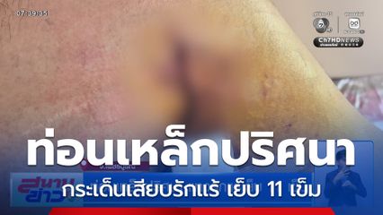 ท่อนเหล็กปริศนา แทงรักแร้เย็บ 11 เข็ม จ.เพชรบูรณ์