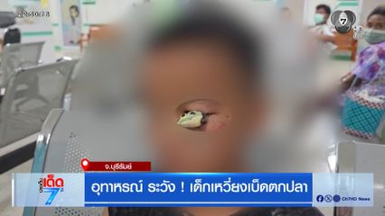 อุทาหรณ์ ระวัง ! เด็กเหวี่ยงเบ็ดตกปลา