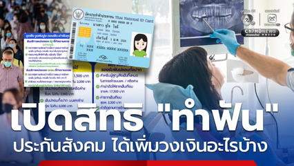เพิ่มสิทธิ! ทันตกรรมผู้ประกันตน เริ่ม 1 พ.ค.มีวงเงินเพิ่ม