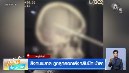 ยิงกบพลาด ถูกลูกดอกเด้งกลับปักเบ้าตา จ.บุรีรัมย์