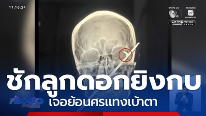 หนุ่มชักลูกดอกยิงกบ เจอย้อนศรแทงเบ้าตา จ.บุรีรัมย์