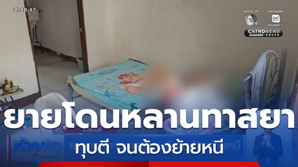 ยายถูกหลานทาสยาทุบตี จนต้องย้ายหนี