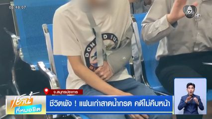 ชีวิตพัง ! แฟนเก่าสาดน้ำกรด คดีไม่คืบหน้า