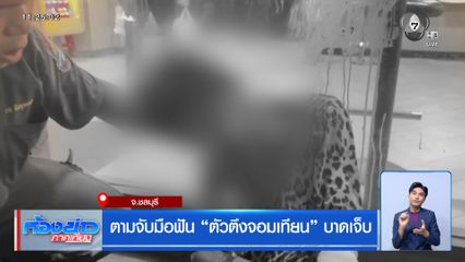 ตามจับมือฟัน ตัวตึงจอมเทียน บาดเจ็บ