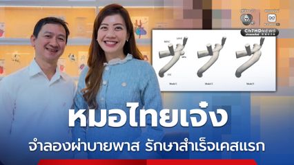 แพทย์ มช. เจ๋ง ใช้โมเดลจำลอง ก่อนผ่าบายพาสหัวใจข้างขวา รักษาโรคหัวใจพิการแต่กำเนิด