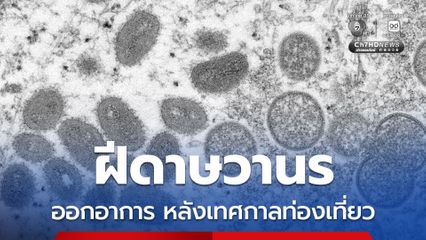 หลังเทศกาลท่องเที่ยว พบผู้ป่วยโรคฝีดาษวานร
