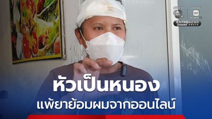 หนุ่มฝากเป็นอุทาหรณ์ หัวเป็นหนอง แพ้รุนแรงน้ำยาย้อมผมจากออนไลน์