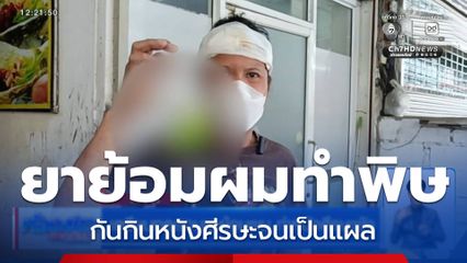 เตรียมทดสอบยาย้อมผม ทำหนังศีรษะพัง