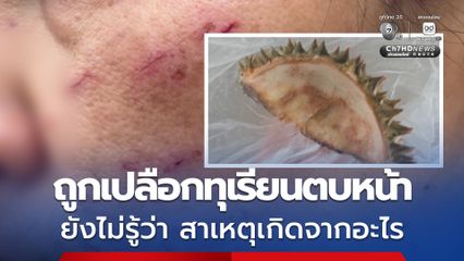 สาวใหญ่ถูกวัยรุ่นชาย 2 คน ใช้เปลือกทุเรียนตบหน้า โดยไม่รู้สาเหตุ