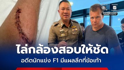 ตร.ไล่กล้องวงจรปิด สอบปมนักแข่งรถ F1 มีบาดแผลลึกที่ข้อเท้า