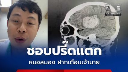 หมอผ่าตัดสมอง ฝากเตือนเจ้านายหรือคนชอบวีน