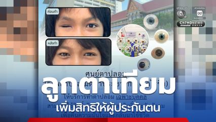 ข่าวดีผู้ประกันตน เพิ่มสิทธิทำลูกตาเทียม