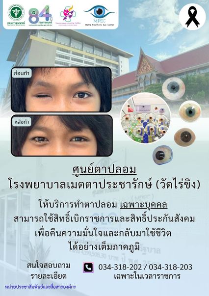 ข่าวดีผู้ประกันตน เพิ่มสิทธิทำลูกตาเทียม