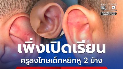 เด็กผวาถูกครูหยิกหูเป็นแผล หลังเล่นรุนแรงกับเพื่อน แม่แจ้งความ ขออย่าลงโทษแบบนี้