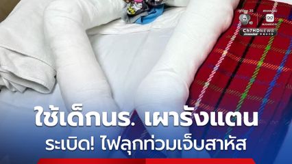 ใช้เด็กนักเรียน เผารังแตน เกิดระเบิด ไฟลุกท่วมเจ็บสาหัส