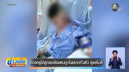 ร้องครูใช้ลูกเผารังแตนถูกไฟลวกทั่วตัว ดูแลไม่ดี