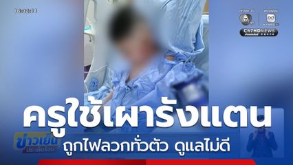 ร้องครูใช้ลูกเผารังแตนถูกไฟลวกทั่วตัว ดูแลไม่ดี